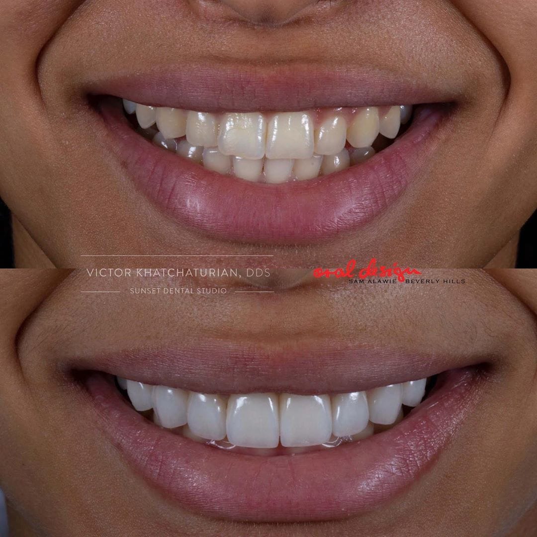 Gallery Before & After Gallery - Patient 4387399 - Image 1
