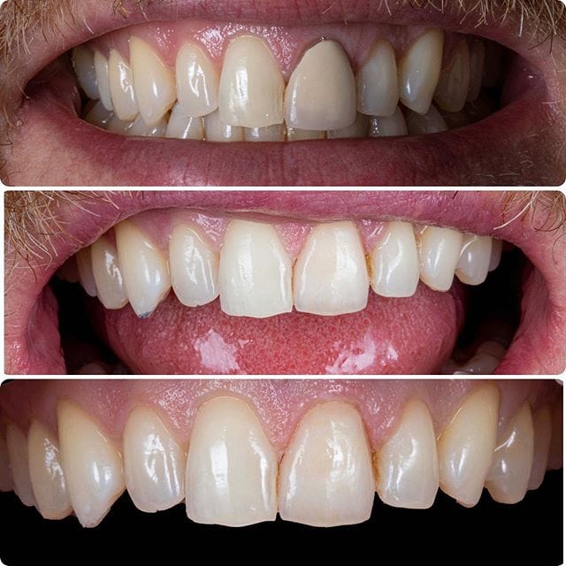 Gallery Before & After Gallery - Patient 4387404 - Image 1