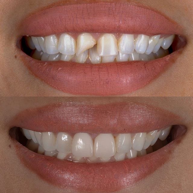 Gallery Before & After Gallery - Patient 4387406 - Image 1
