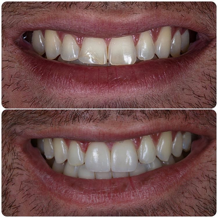 Gallery Before & After Gallery - Patient 4387407 - Image 1