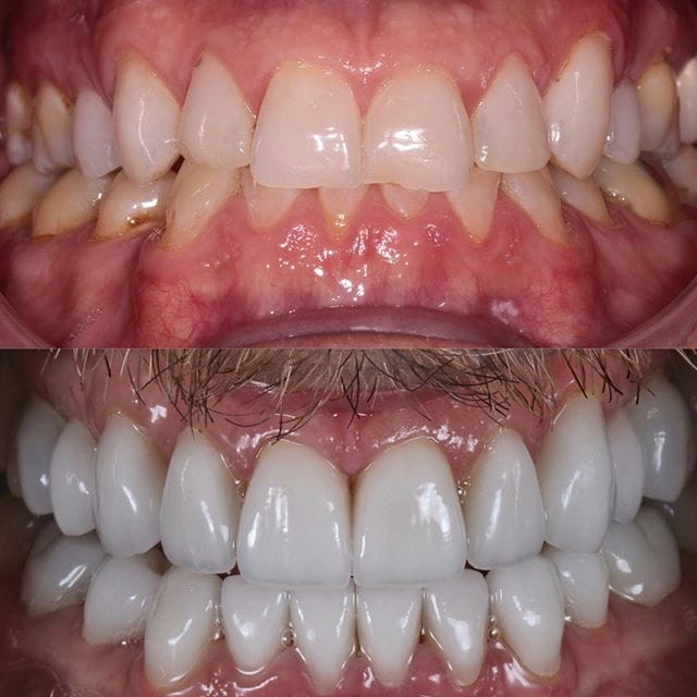 Gallery Before & After Gallery - Patient 4387409 - Image 1