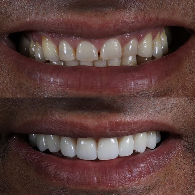 Gallery Before & After Gallery - Patient 4387410 - Image 1