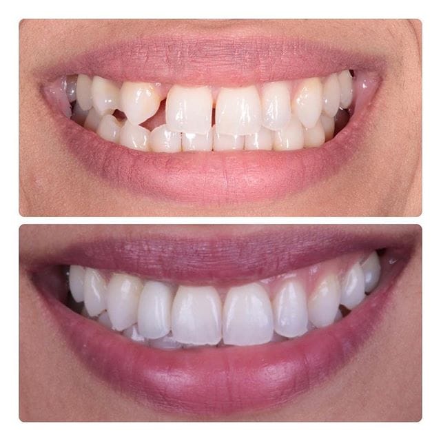 Gallery Before & After Gallery - Patient 4387412 - Image 1
