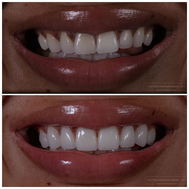 Gallery Before & After Gallery - Patient 4387416 - Image 1