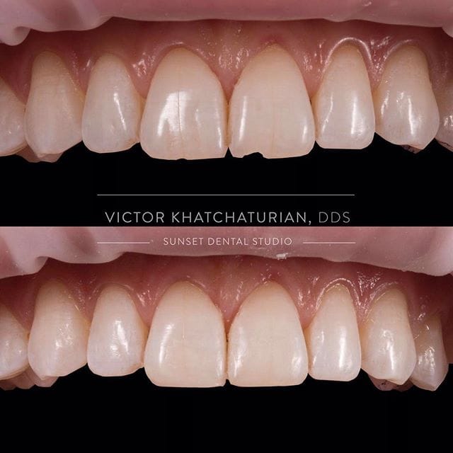 Gallery Before & After Gallery - Patient 4387427 - Image 1