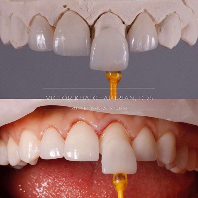Gallery Before & After Gallery - Patient 4387429 - Image 1