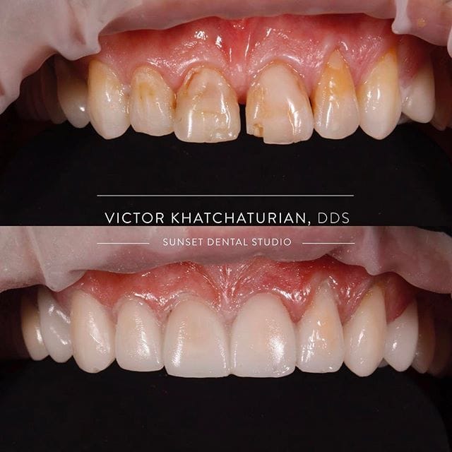 Gallery Before & After Gallery - Patient 4387430 - Image 1