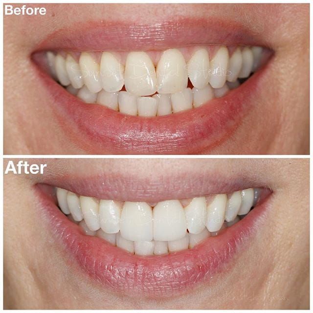 Gallery Before & After Gallery - Patient 4387443 - Image 1